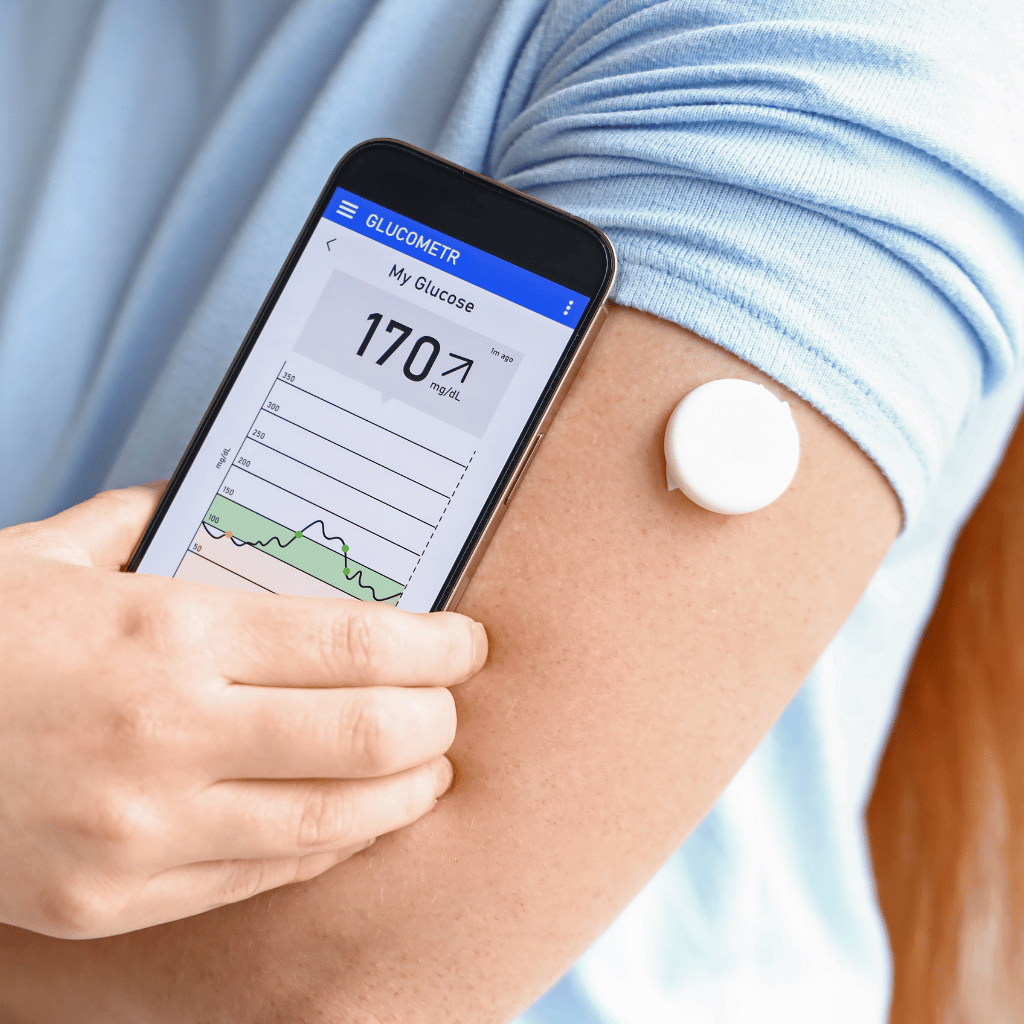Continuous Glucose Monitor with App on Phone, HRX